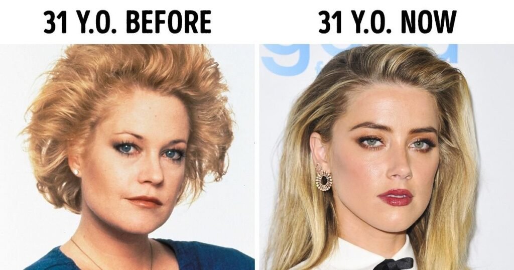 15 Celebrities Who Have Aged Terribly. #8 Is Unreal